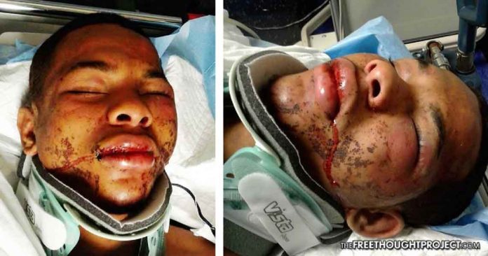 assaulted by police