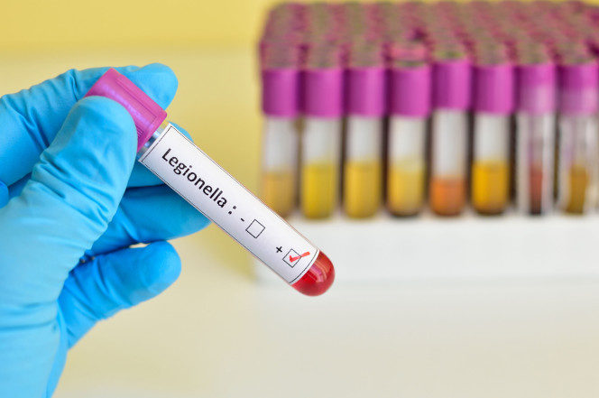 Click to enlarge legionella