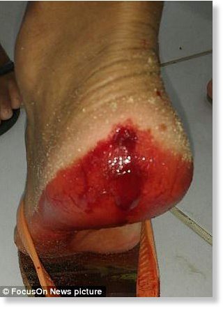 Click to enlarge blood