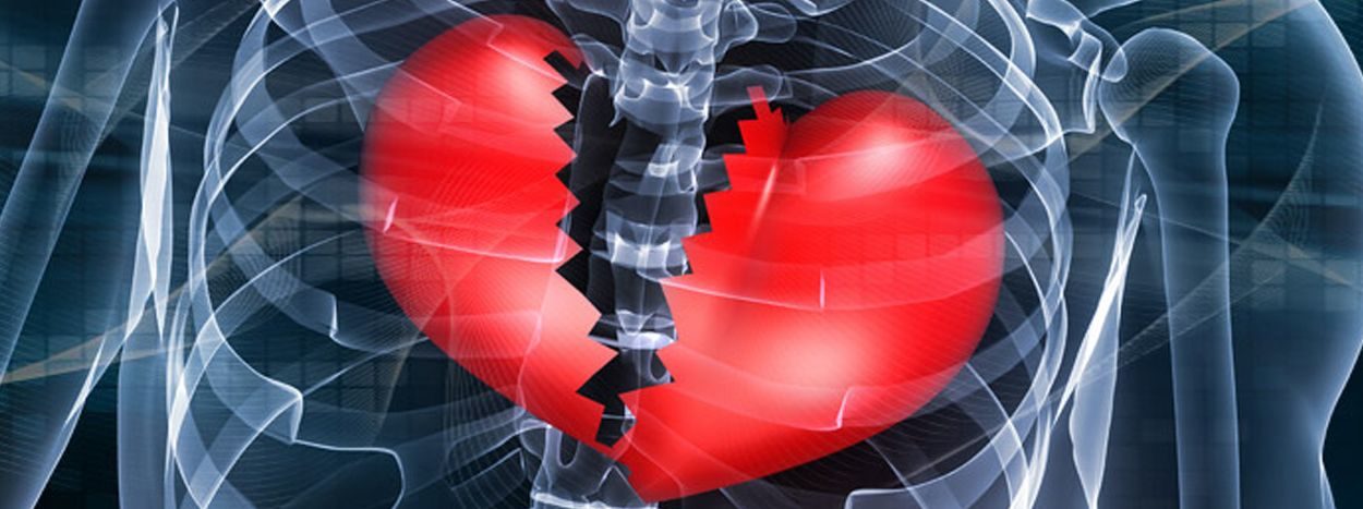 Click to enlarge broken heart syndrome