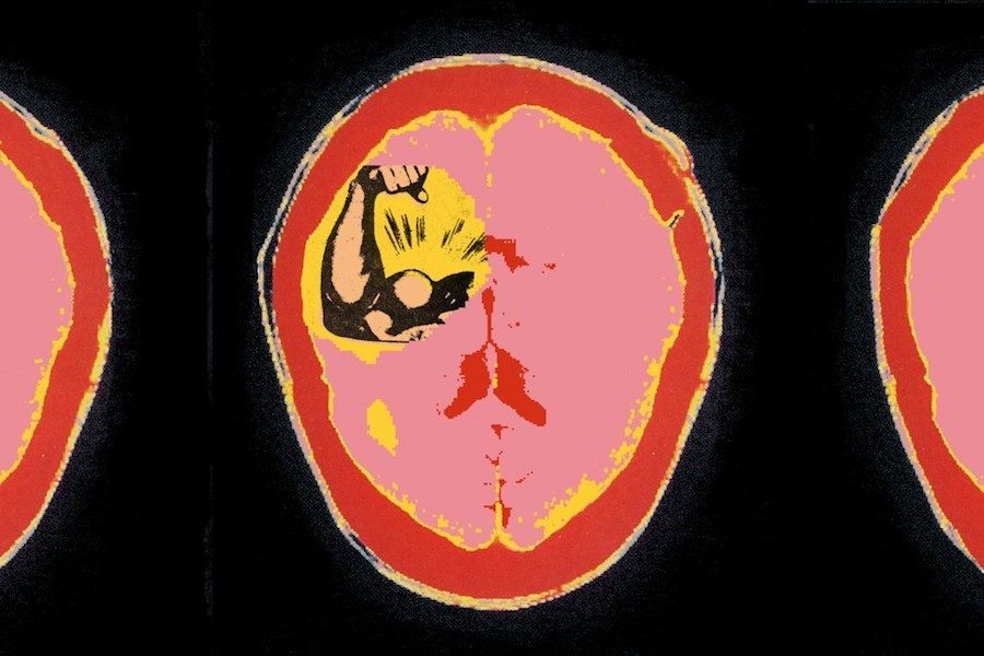 Click to enlarge brain damage