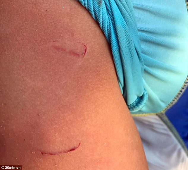 A woman was left needing stitches and an eight-year-old suffered cuts (pictured) after they were bitten by a particularly aggressive beaver in Switzerland