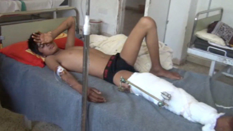 Injured Raqqa civilian