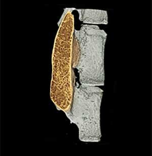 spine bone