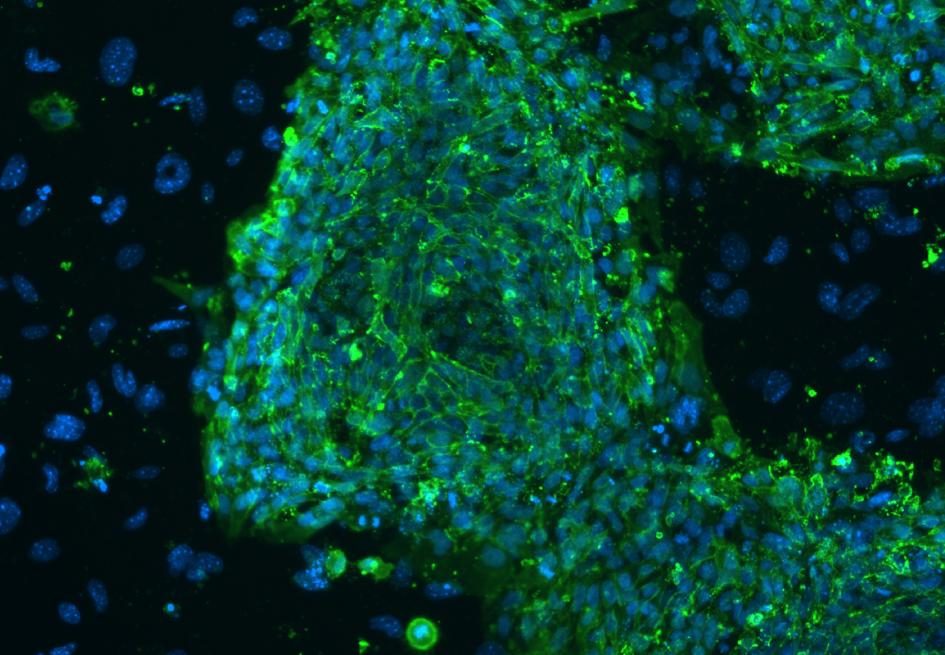 Click to enlarge embryonic stem cells