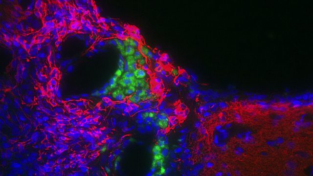 Click to enlarge neural stem cells