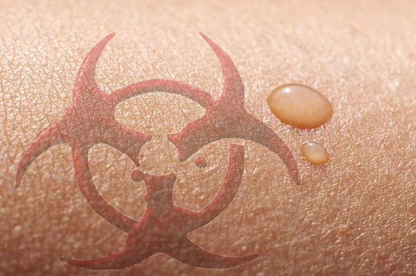 sweating toxins