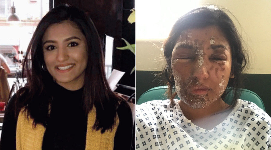 Click to enlarge Acid attack