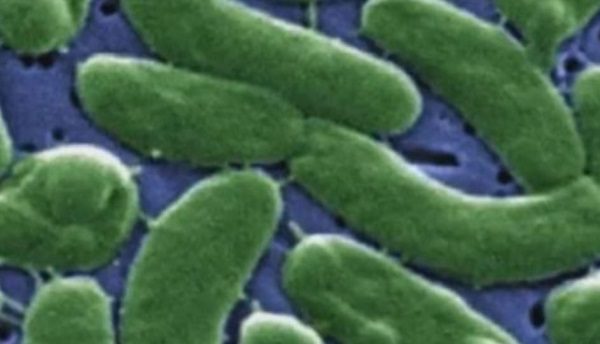 Click to enlarge vibrio