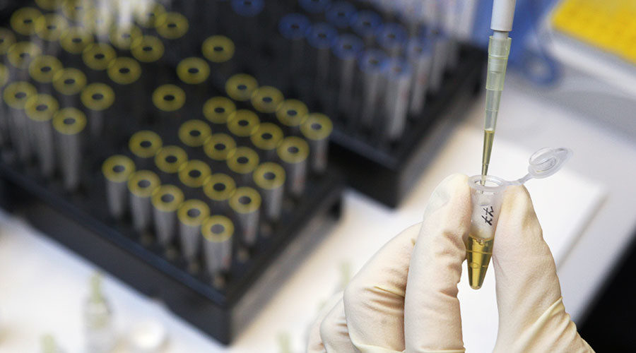 urine test