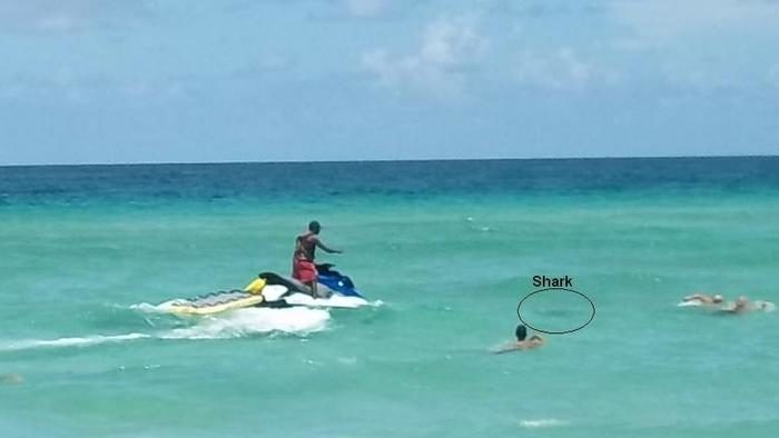 A man was bitten in both legs Sunday afternoon while swimming off Haulover Beach in Miami-Dade County.