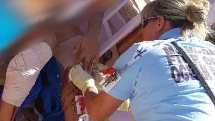 Click to enlarge A man was bitten in both legs Sunday afternoon while swimming off Haulover Beach in Miami-Dade County.