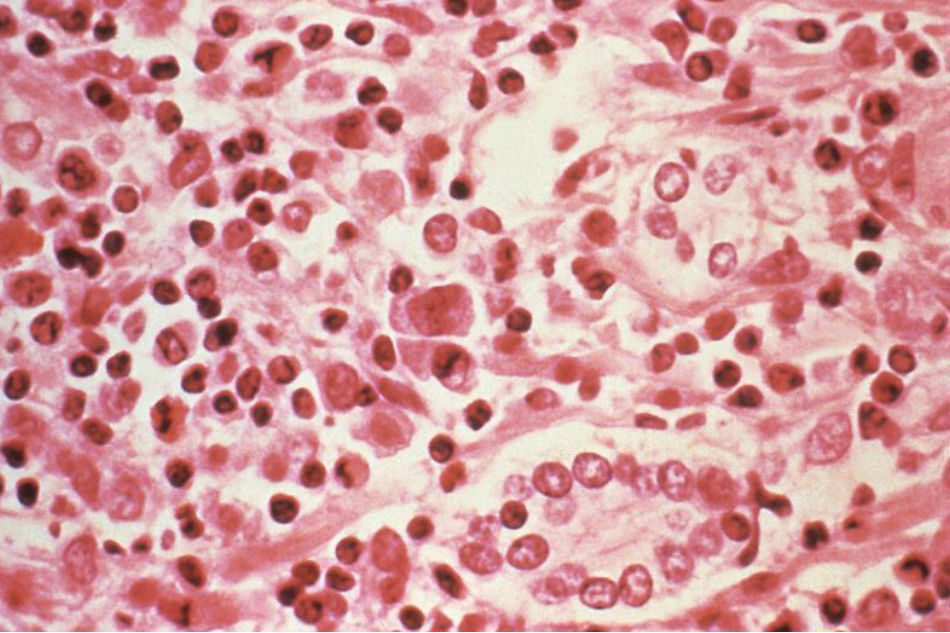 Click to enlarge Hantavirus kills three in Washington