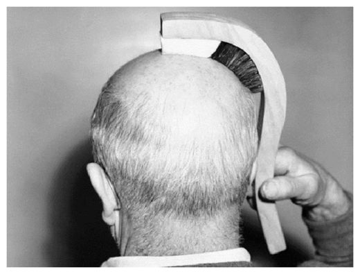Bald Man
