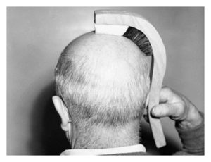 Bald Man