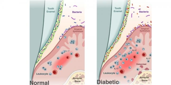 Click to enlarge oral microbiome diabetes