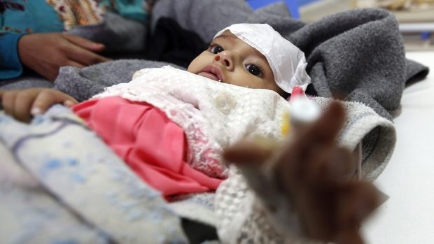 Click to enlarge Yemini infant suspected of cholera infection