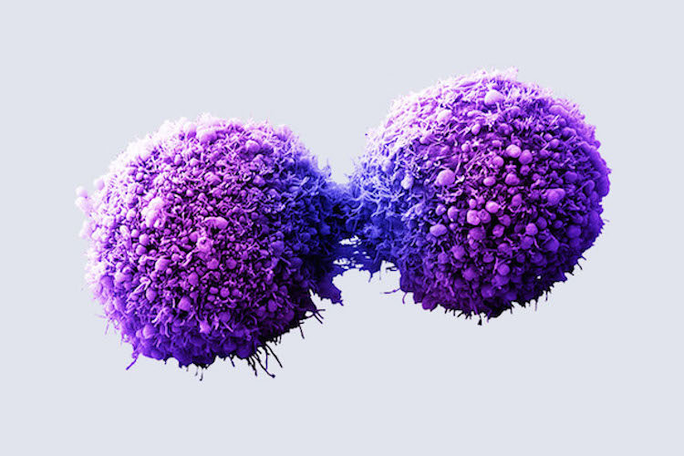 cancer cells
