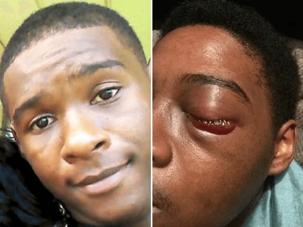 Click to enlarge Teen Beaten