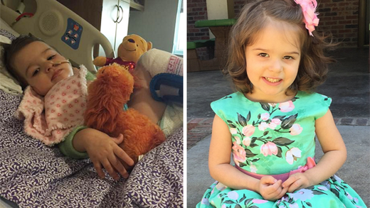 Hyperbaric oxygen therapy reverses toddler's brain damage