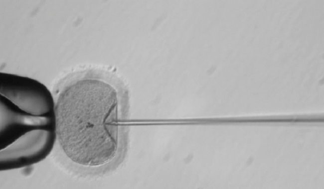 Human Embryo