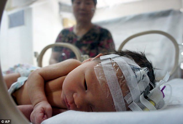 Baby Mongolia Infant Abortion
