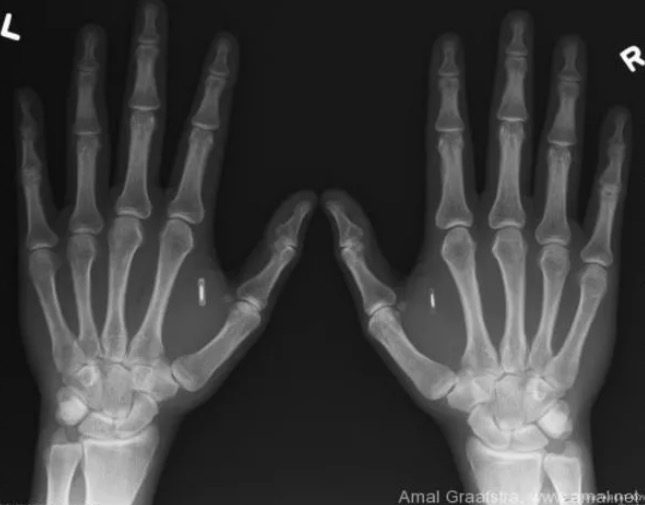 Click to enlarge RFID's under x-rays