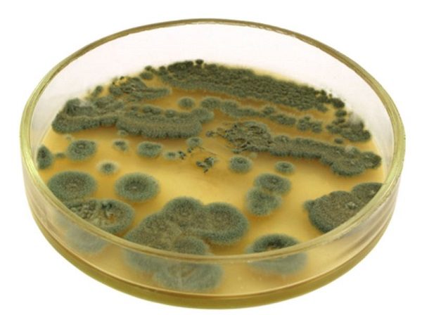 bacteria petri dish