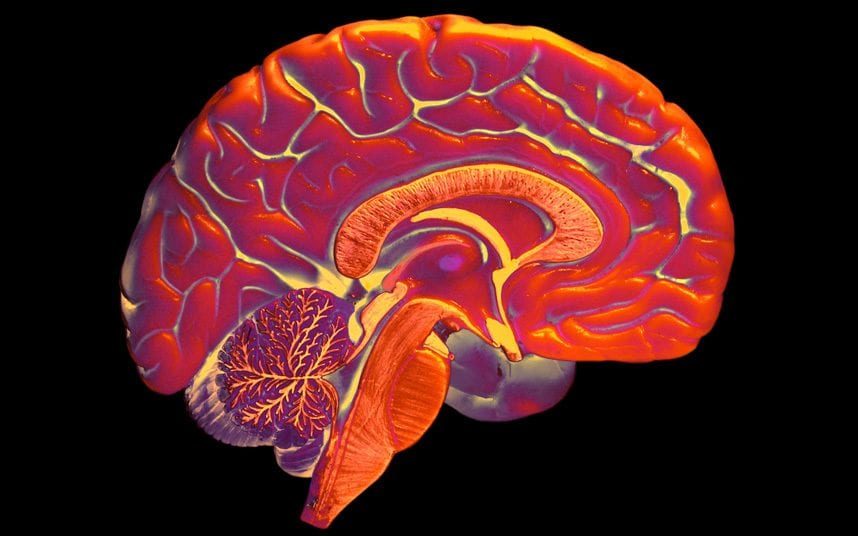 Click to enlarge brain