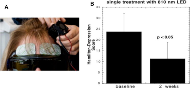 Click to enlarge low level light therapy