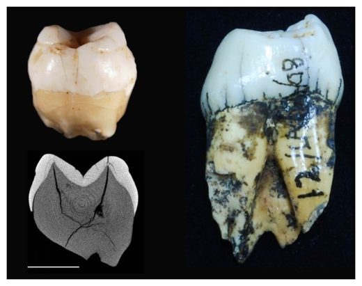 Click to enlarge Ancient Human Tooth