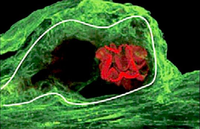 horseshoe crab photoreceptor cell
