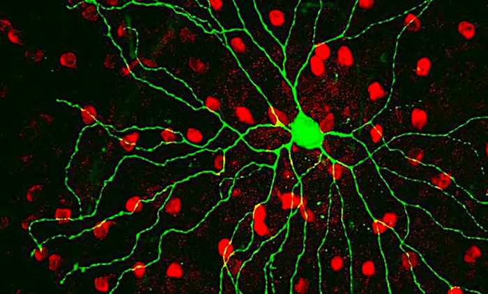 nerve cell mouse retina