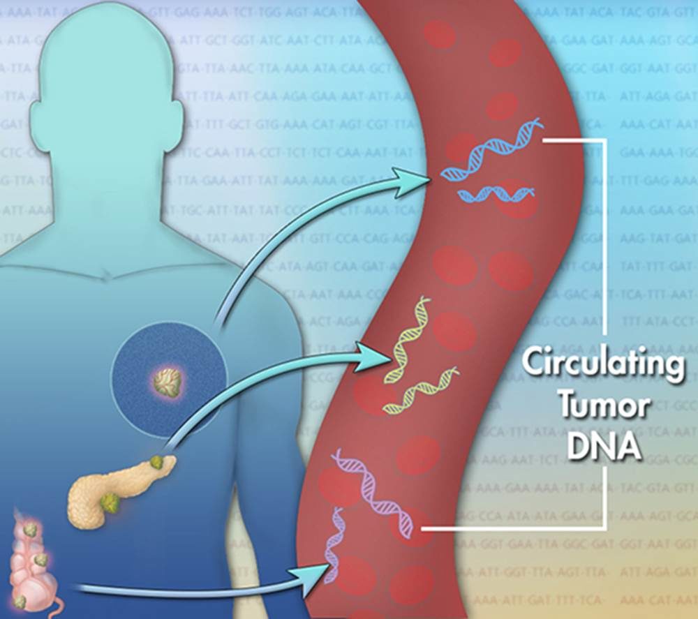 Click to enlarge cancer blood test
