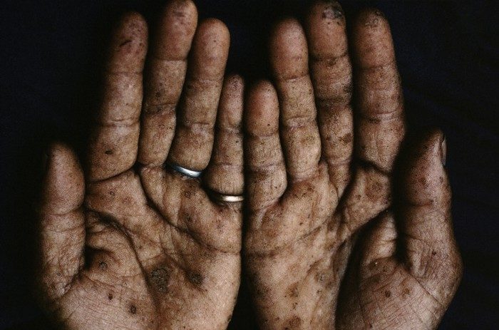 Click to enlarge arsenic