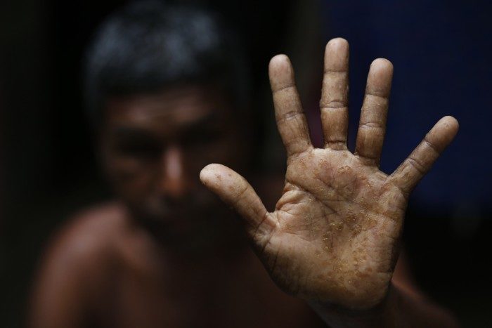 Click to enlarge arsenic