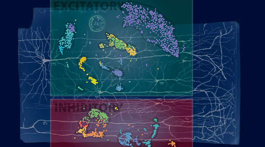 Click to enlarge Brain