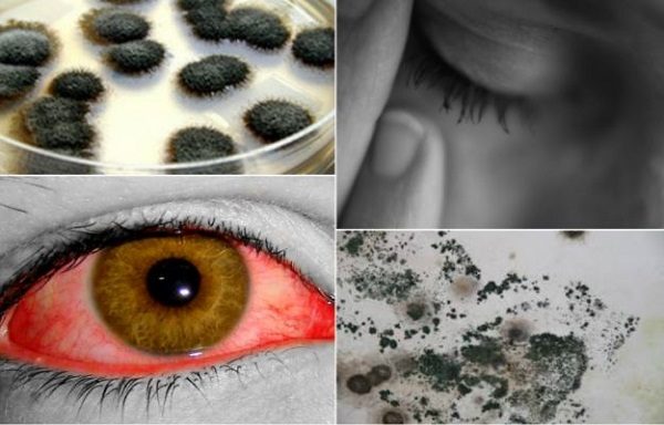 mold illness