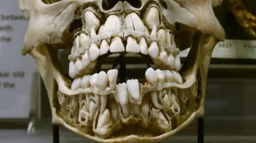 teeth double range