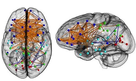 Click to enlarge brain neural map