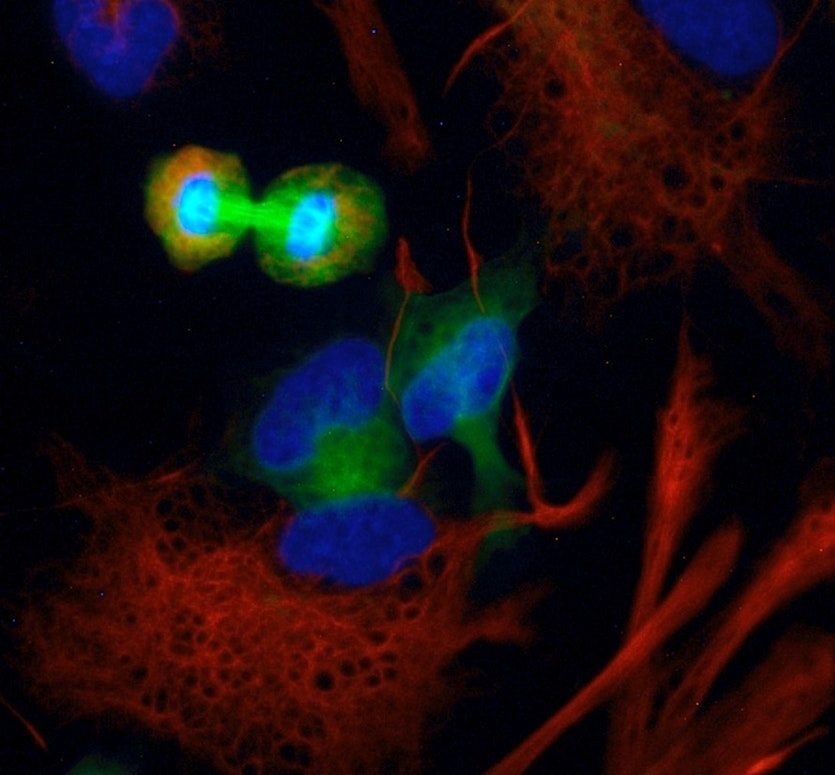 human stem cell