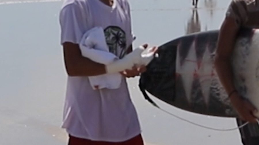 SHARK BITE
