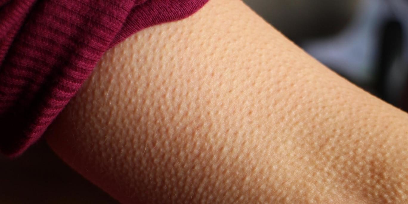 Click to enlarge goosebumps