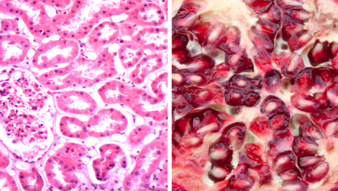 Click to enlarge pomegranate