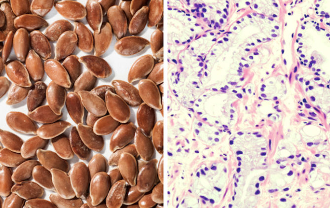 Click to enlarge flaxseed