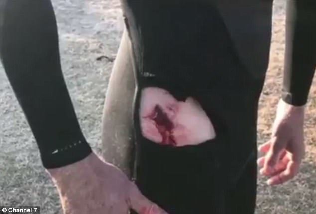 A surfer was bitten by a shark at Iluka on the NSW North Coast.
