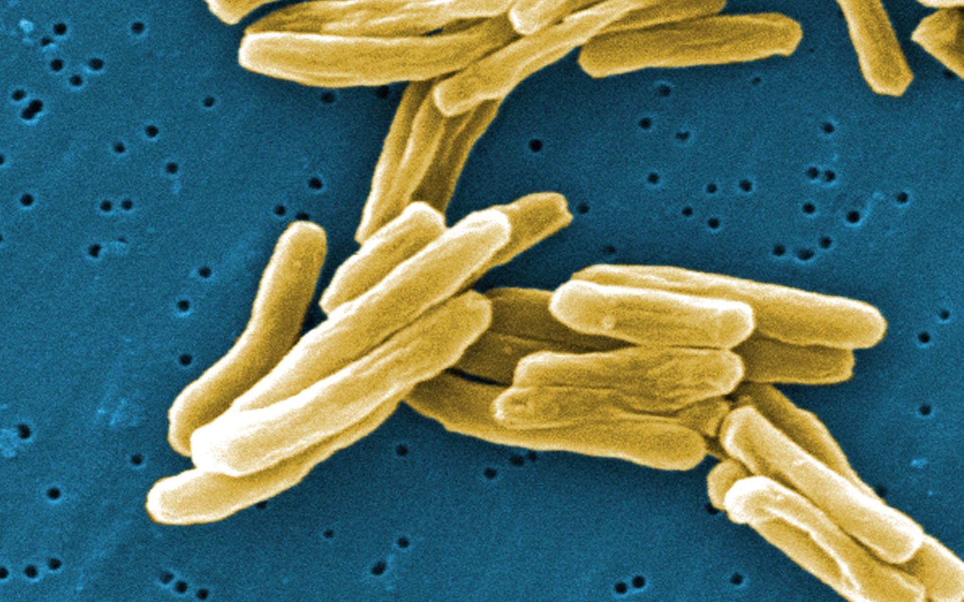 Click to enlarge Tuberculosis bacteria