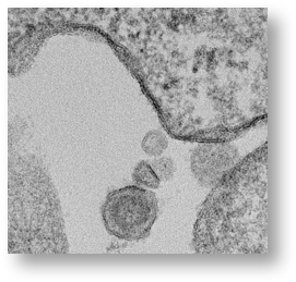 Click to enlarge retrovirus