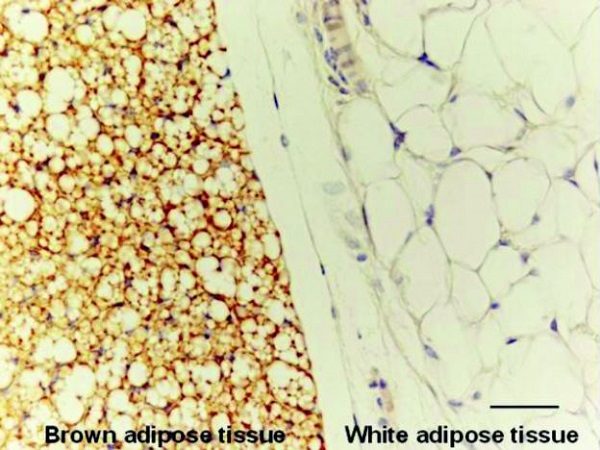 brown and white fat