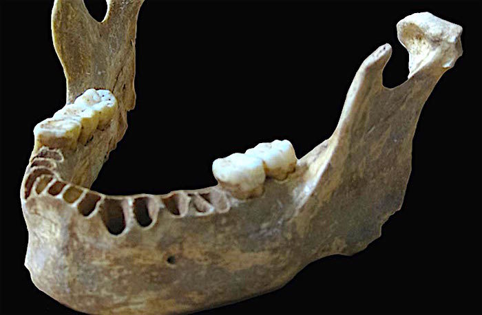 jawbone